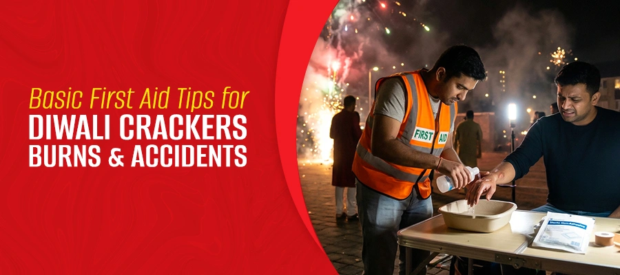 Basic First Aid Tips for Diwali Crackers Burns and Accidents